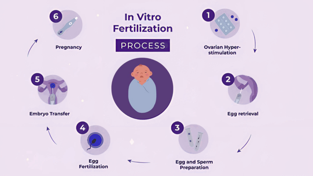IVF cost in delhi